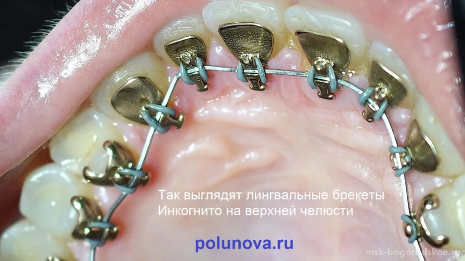Ортодонт-центр Ортодонтика Изображение 20