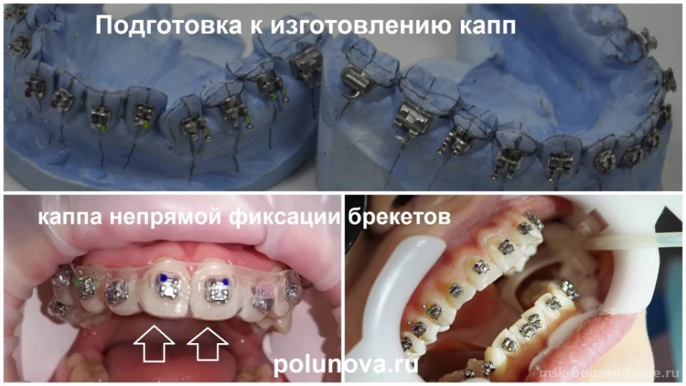 Ортодонт-центр Ортодонтика Изображение 9