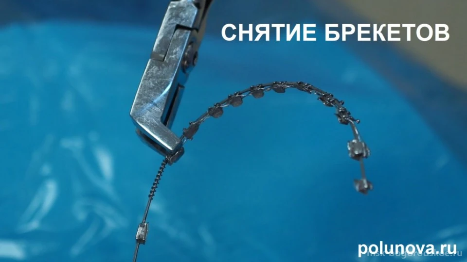 Ортодонт-центр Ортодонтика Изображение 14