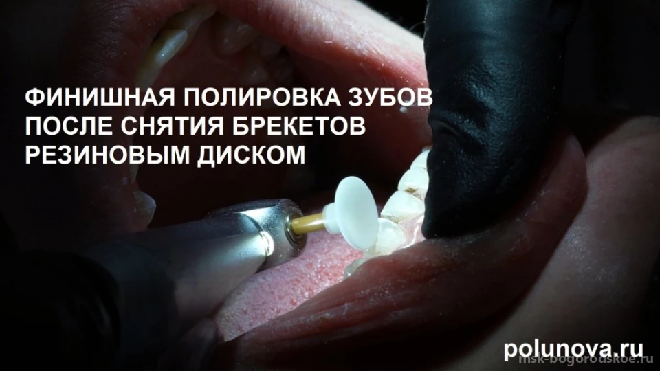 Ортодонт-центр Ортодонтика Изображение 17