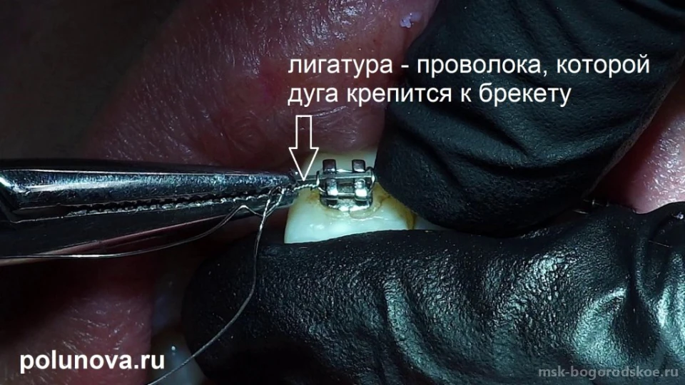 Ортодонт-центр Ортодонтика Изображение 4