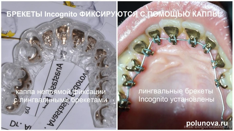 Ортодонт-центр Ортодонтика Изображение 10